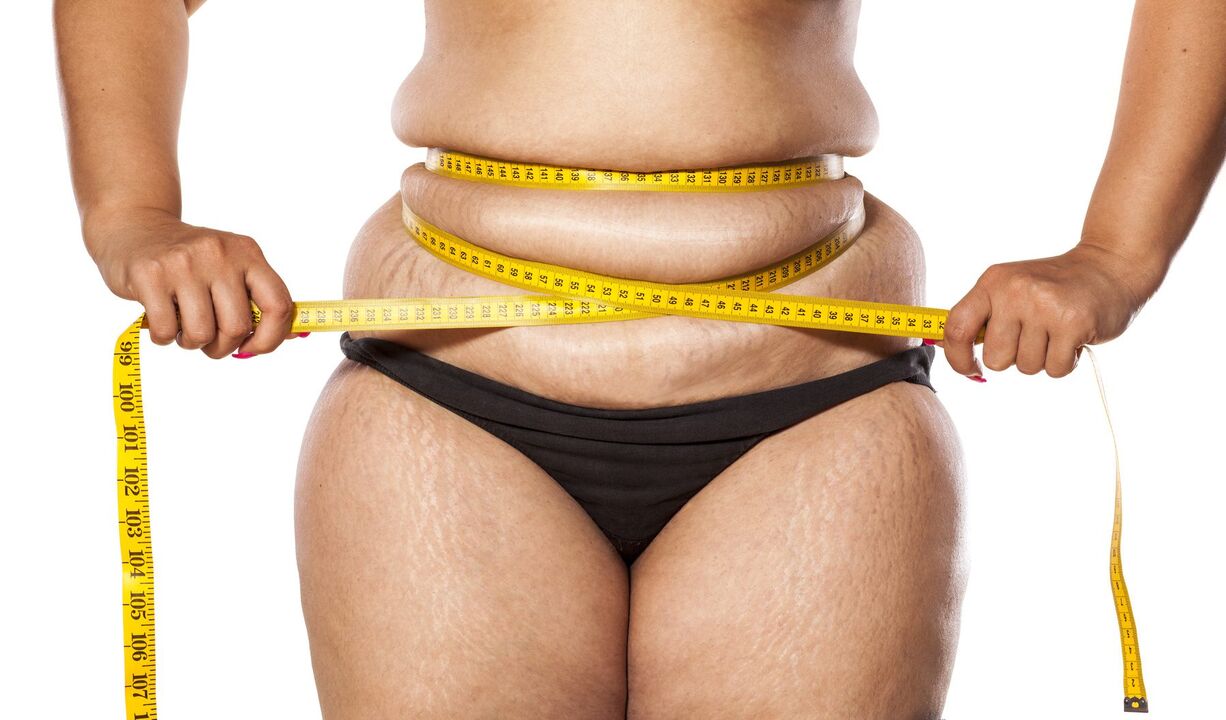 Excès de poids et perte de poids en utilisant Keto Probiotix